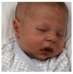 Zachary Diecker