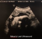 Nikoo Alice Izadseta