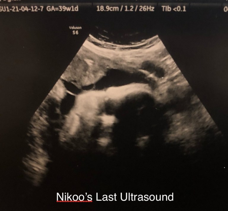 Nikoo Alice Izadseta